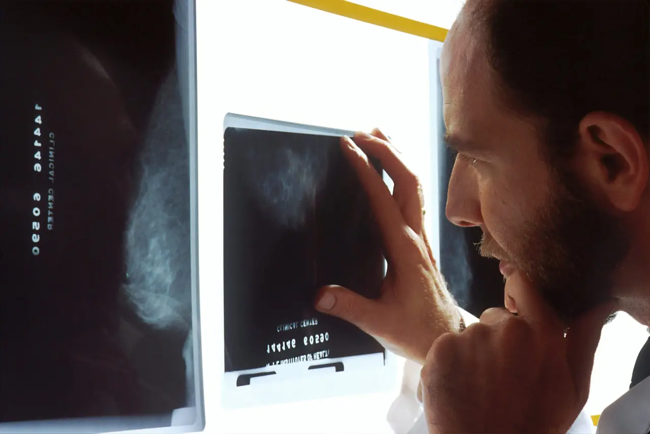 AI could help detect common cardiovascular diseases from mammograms