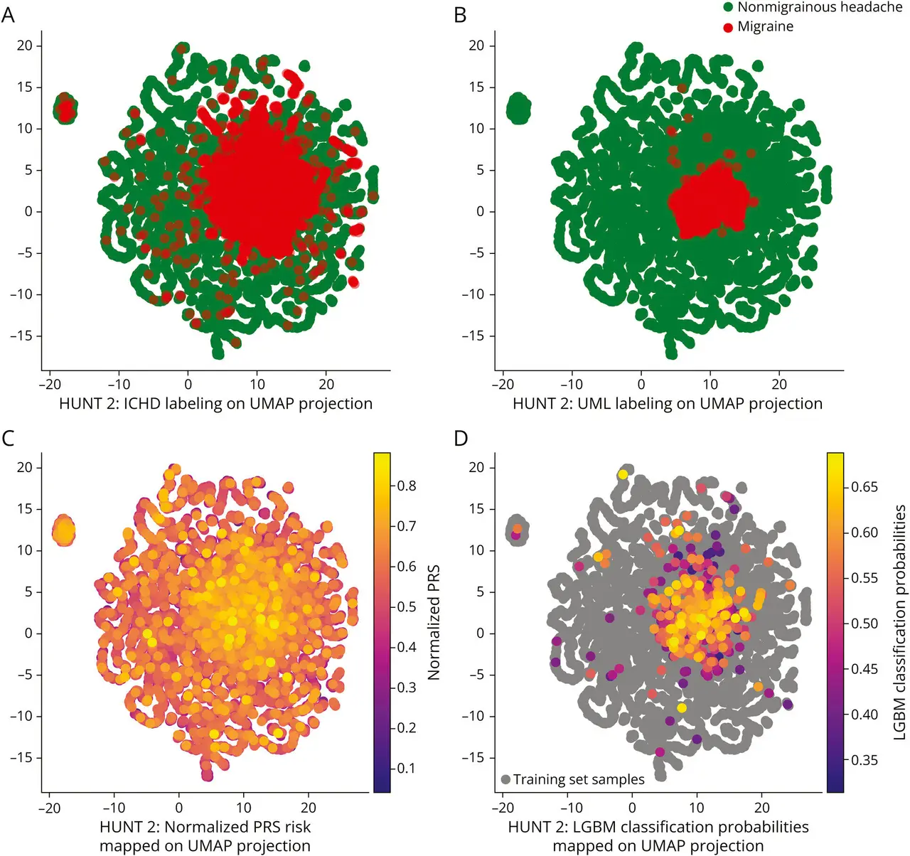 Migraine may leave bodywide clues, AI analysis of 43,000 people suggests
